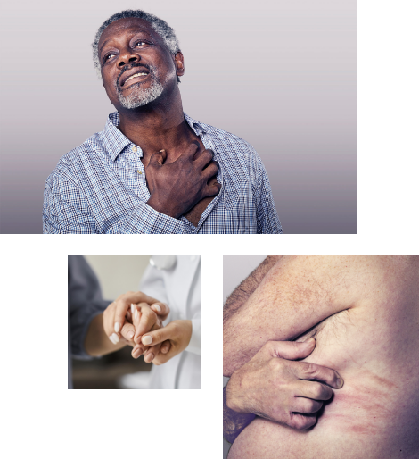 A collage of three pictures showcasing a man with his shirt open at the top scratching his chest, his face showing discomfort, a close up of a medical professional holding the hand of a patient and a closeup of a male torso, side view showing his hand itching himself.