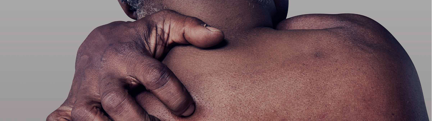 An older man, shirtless, facing away his arm is reaching over his shoulder itching his back.